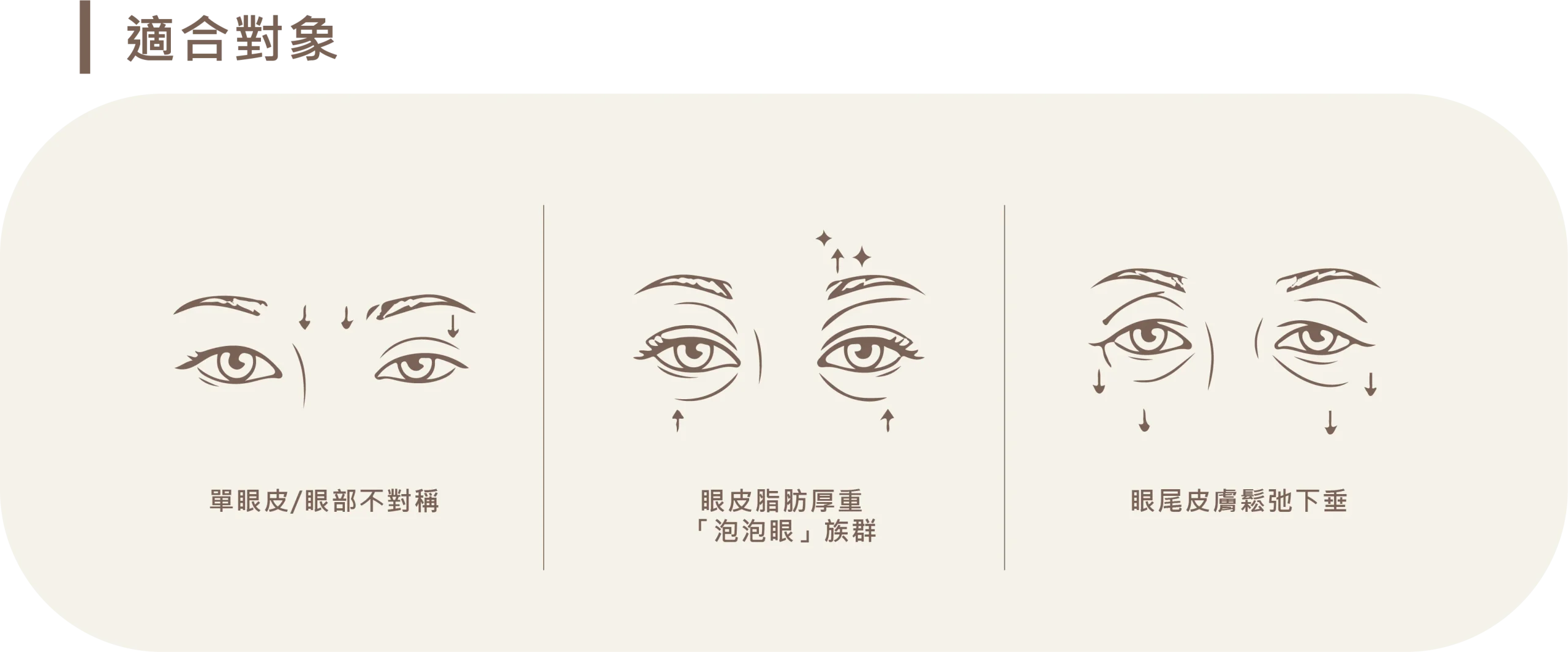 雙眼皮手術適合對象圖示，包含：單眼皮或眼部不對稱、眼皮脂肪厚重的「泡泡眼」族群，以及眼尾皮膚鬆弛下垂者。