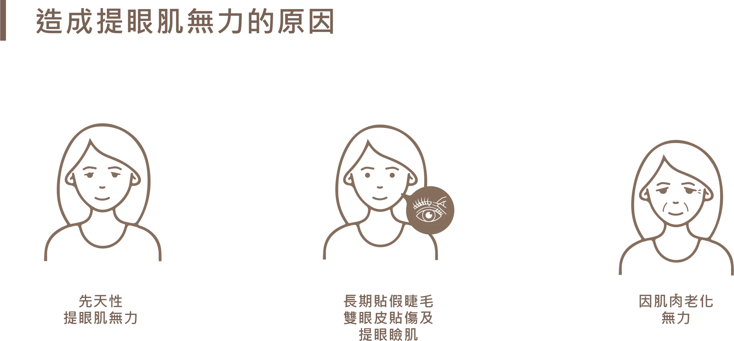 造成提眼肌無力的三大原因圖示：包含先天性提眼肌無力、長期貼假睫毛與雙眼皮貼傷及提眼瞼肌，以及因肌肉老化造成的無力。
