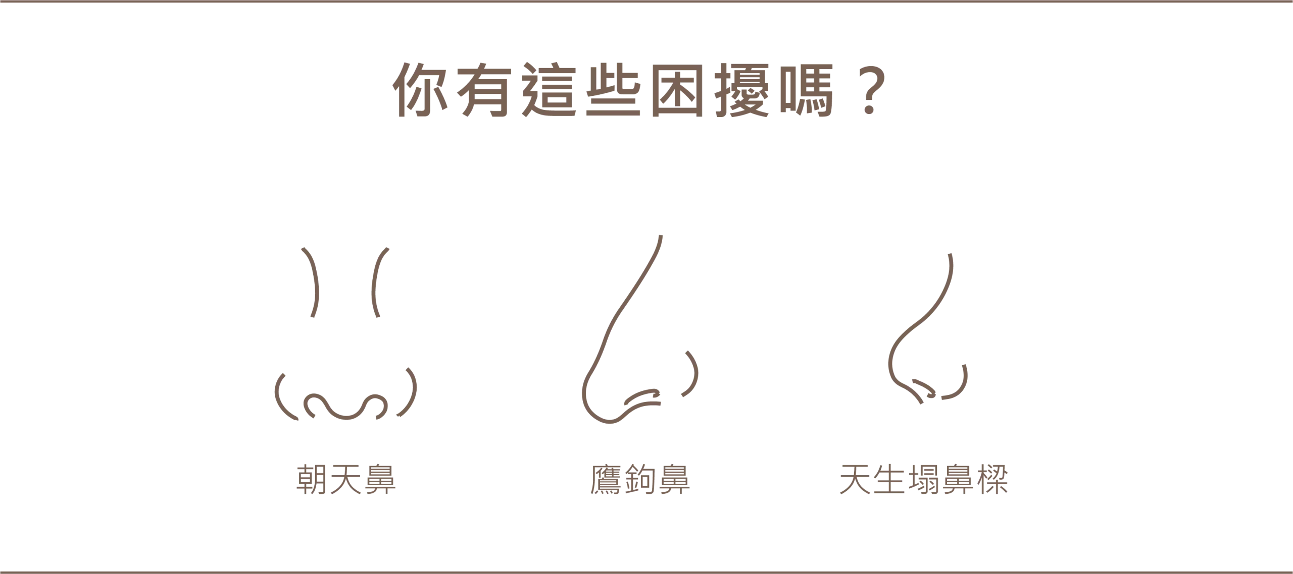 常見不良鼻型困擾圖示，包含：朝天鼻、鷹鉤鼻與天生塌鼻樑。