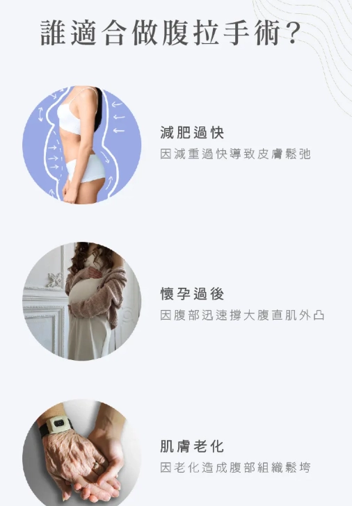 適合腹部拉皮手術的三大族群圖示：包含減肥過快導致皮膚鬆弛者、懷孕過後因腹部撐大導致腹直肌外凸者，以及因肌膚老化造成腹部組織鬆垮者。